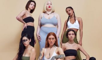 Псориаз, веснушки и шрамы. Missguided (снова) снял в рекламе моделей с особенностями. И теперь получилось